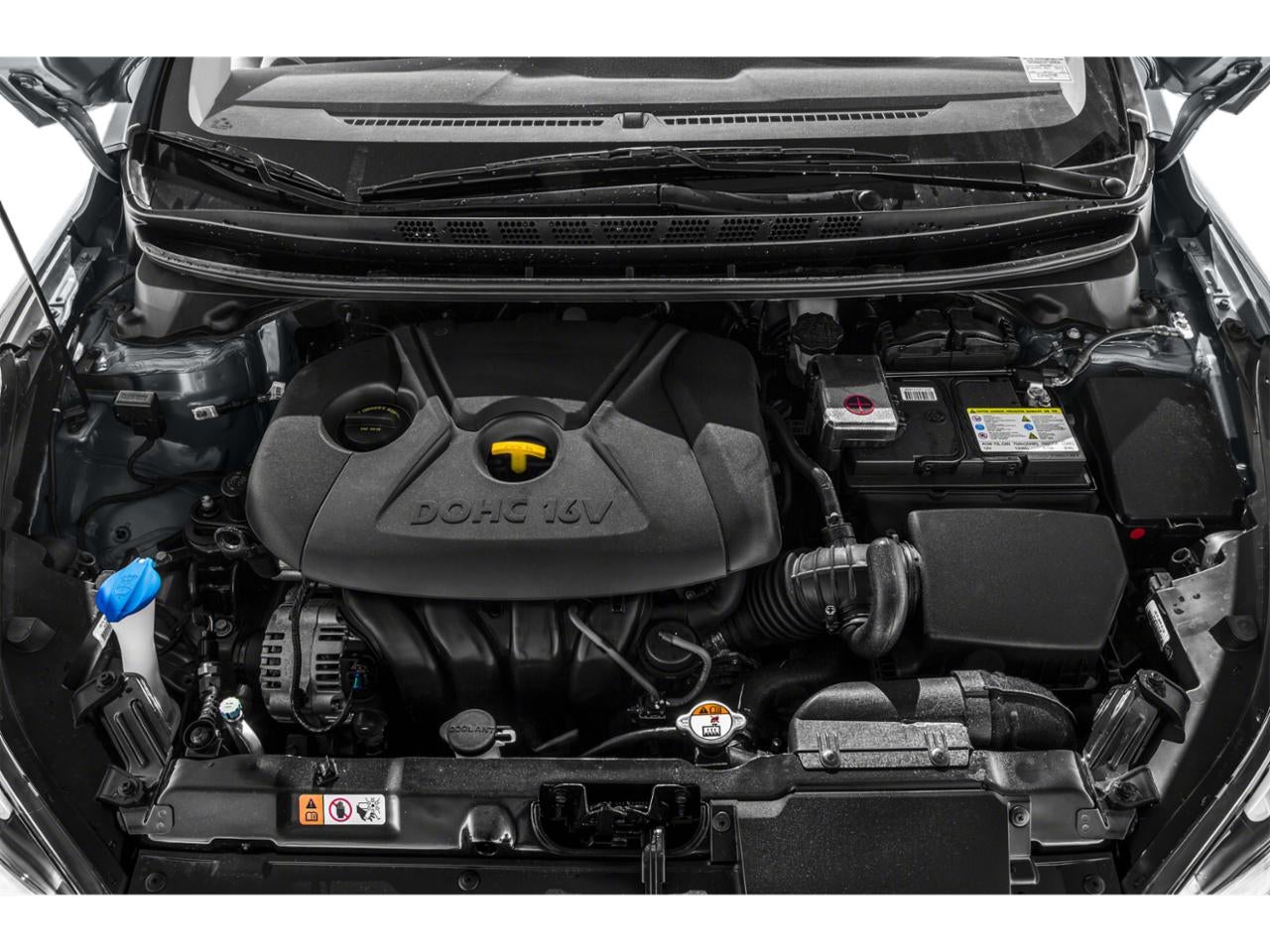 2015 Hyundai Elantra 4dr Sdn Auto SE